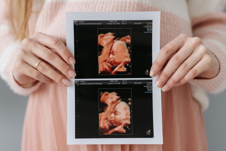 What is a 3D and 4D Ultrasound? Everything You Need to Know